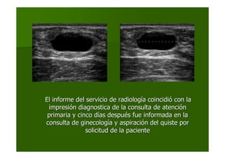 El informe del servicio de radiologEl informe del servicio de radiologíía coincidia coincidióó con lacon la
impresiimpresióón diagnostica de la consulta de atencin diagnostica de la consulta de atencióónn
primaria y cinco dprimaria y cinco díías despuas despuéés fue informada en las fue informada en la
consulta de ginecologconsulta de ginecologíía y aspiracia y aspiracióón del quiste porn del quiste por
solicitud de la pacientesolicitud de la paciente
 