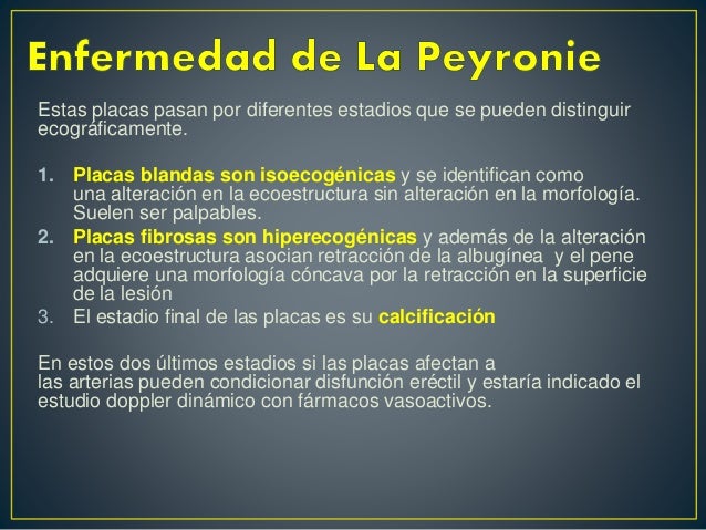 Ecografia de pene