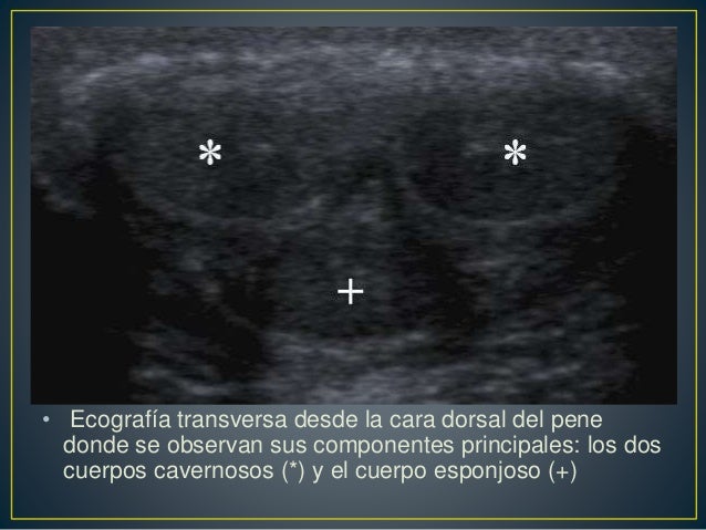 Fuera de pene Insano grandes naturales