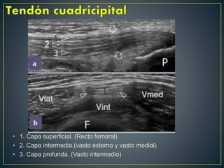 • 1. Capa superficial. (Recto femoral)
• 2. Capa intermedia.(vasto externo y vasto medial)
• 3. Capa profunda. (Vasto intermedio)
 