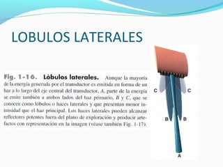 LOBULOS LATERALES