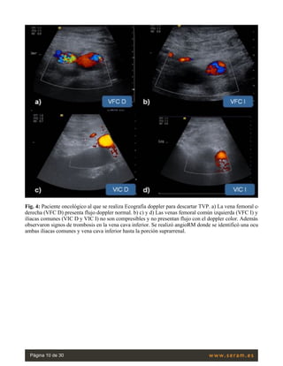 ecografia doppler de miembros inferiores.pdf