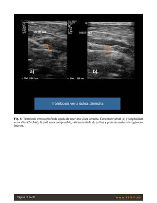 ecografia doppler de miembros inferiores.pdf