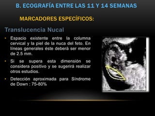 Translucencia Nucal
• Espacio existente entre la columna
cervical y la piel de la nuca del feto. En
líneas generales éste deberá ser menor
de 2.5 mm.
• Si se supera esta dimensión se
considera positivo y se sugerirá realizar
otros estudios.
• Detección aproximada para Síndrome
de Down : 75-80%
MARCADORES ESPECÍFICOS:
 