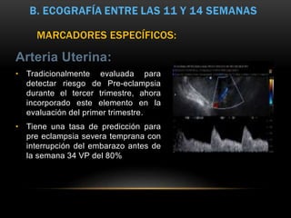 Arteria Uterina:
• Tradicionalmente evaluada para
detectar riesgo de Pre-eclampsia
durante el tercer trimestre, ahora
incorporado este elemento en la
evaluación del primer trimestre.
• Tiene una tasa de predicción para
pre eclampsia severa temprana con
interrupción del embarazo antes de
la semana 34 VP del 80%
MARCADORES ESPECÍFICOS:
 