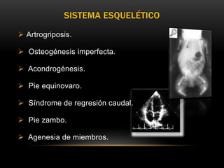  Artrogriposis.
 Osteogénesis imperfecta.
 Acondrogénesis.
 Pie equinovaro.
 Síndrome de regresión caudal.
 Pie zambo.
 Agenesia de miembros.
SISTEMA ESQUELÉTICO
 