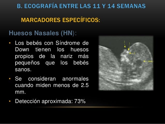 Ecografia En Obstetricia Ecografia En Obstetricia
