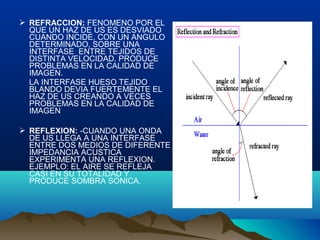  REFRACCION: FENOMENO POR EL
QUE UN HAZ DE US ES DESVIADO
CUANDO INCIDE, CON UN ANGULO
DETERMINADO, SOBRE UNA
INTERFASE ENTRE TEJIDOS DE
DISTINTA VELOCIDAD. PRODUCE
PROBLEMAS EN LA CALIDAD DE
IMAGEN.
LA INTERFASE HUESO TEJIDO
BLANDO DEVIA FUERTEMENTE EL
HAZ DE US CREANDO A VECES
PROBLEMAS EN LA CALIDAD DE
IMAGEN
 REFLEXION: -CUANDO UNA ONDA
DE US LLEGA A UNA INTERFASE
ENTRE DOS MEDIOS DE DIFERENTE
IMPEDANCIA ACUSTICA
EXPERIMENTA UNA REFLEXION.
EJEMPLO: EL AIRE SE REFLEJA
CASI EN SU TOTALIDAD Y
PRODUCE SOMBRA SONICA.
 