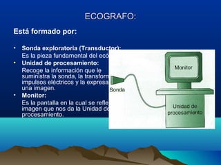 ECOGRAFO:ECOGRAFO:
Está formado por:
• Sonda exploratoria (Transductor):
Es la pieza fundamental del ecógrafo.
• Unidad de procesamiento:
Recoge la información que le
suministra la sonda, la transforma en
impulsos eléctricos y la expresa en
una imagen.
• Monitor:
Es la pantalla en la cual se refleja la
imagen que nos da la Unidad de
procesamiento.
 