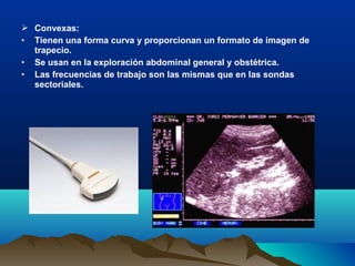  Convexas:
• Tienen una forma curva y proporcionan un formato de imagen de
trapecio.
• Se usan en la exploración abdominal general y obstétrica.
• Las frecuencias de trabajo son las mismas que en las sondas
sectoriales.
 
