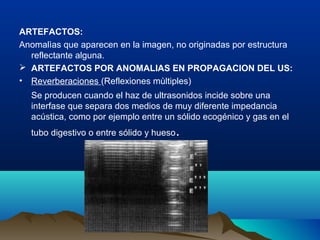 ARTEFACTOS:
Anomalìas que aparecen en la imagen, no originadas por estructura
reflectante alguna.
 ARTEFACTOS POR ANOMALIAS EN PROPAGACION DEL US:
• Reverberaciones (Reflexiones mùltiples)
Se producen cuando el haz de ultrasonidos incide sobre una
interfase que separa dos medios de muy diferente impedancia
acústica, como por ejemplo entre un sólido ecogénico y gas en el
tubo digestivo o entre sólido y hueso.
 