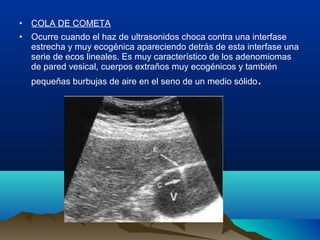 • COLA DE COMETA
• Ocurre cuando el haz de ultrasonidos choca contra una interfase
estrecha y muy ecogénica apareciendo detrás de esta interfase una
serie de ecos lineales. Es muy característico de los adenomiomas
de pared vesical, cuerpos extraños muy ecogénicos y también
pequeñas burbujas de aire en el seno de un medio sólido.
 