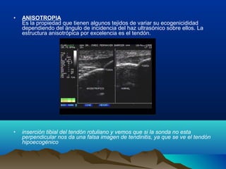 • ANISOTROPIA
Es la propiedad que tienen algunos tejidos de variar su ecogenicididad
dependiendo del ángulo de incidencia del haz ultrasónico sobre ellos. La
estructura anisotrópica por excelencia es el tendón.
• inserción tibial del tendón rotuliano y vemos que si la sonda no esta
perpendicular nos da una falsa imagen de tendinitis, ya que se ve el tendón
hipoecogénico
 