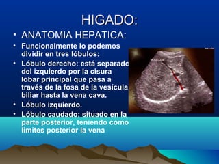 HIGADO:HIGADO:
• ANATOMIA HEPATICA:
• Funcionalmente lo podemos
dividir en tres lóbulos:
• Lóbulo derecho: está separado
del izquierdo por la cisura
lobar principal que pasa a
través de la fosa de la vesícula
biliar hasta la vena cava.
• Lóbulo izquierdo.
• Lóbulo caudado: situado en la
parte posterior, teniendo como
limites posterior la vena
 