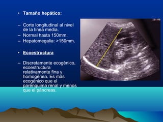• Tamaño hepático:
– Corte longitudinal al nivel
de la línea media.
– Normal hasta 150mm.
– Hepatomegalia: >150mm.
• Ecoestructura
– Discretamente ecogènico,
ecoestructura
relativamente fina y
homogénea. Es más
ecogénico que el
parénquima renal y menos
que el páncreas.
 