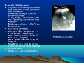 Metàstasis de ColonMetàstasis de Colon
Lesiones hiperecoicas :
• Angioma: Tumor benigno hepàtico
màs frecuente; ùnicos, perifèricos,
bien delimitados.
suelen ser hallazgos casuales
(incidentalomas).
Si hay dudas, TAC helicoidal, MR,
PET ,gammagrafìa con hematìes
marcados.
• Metàstasis-mùltiples: el 30 % son
hiperecoicas
• Esteatosis parcheada.
• Adenoma: Raro, en jòvenes con
toma de anticonceptivos o
anabolizantes, ùnicos, de 8 a 15
cms , son quirurgcos
por su tendencia a la rotura y al
sangrado.
• Hepatoma en el seno de cirrosis ,
a veces trombosis portal asociada
• Angiosarcoma
• Grasa en el ligamento falciforme
 