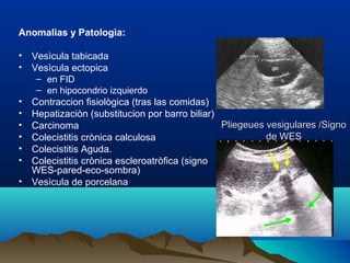 Pliegeues vesigulares /SignoPliegeues vesigulares /Signo
de WESde WES
Anomalias y Patologìa:
• Vesìcula tabicada
• Vesìcula ectopica
– en FID
– en hipocondrio izquierdo
• Contraccion fisiològica (tras las comidas)
• Hepatizaciòn (substitucion por barro biliar)
• Carcinoma
• Colecistitis crònica calculosa
• Colecistitis Aguda.
• Colecistitis crònica escleroatròfica (signo
WES-pared-eco-sombra)
• Vesìcula de porcelana
 
