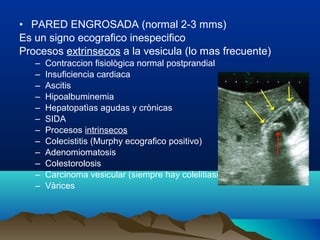 • PARED ENGROSADA (normal 2-3 mms)
Es un signo ecografico inespecifico
Procesos extrinsecos a la vesicula (lo mas frecuente)
– Contraccion fisiològica normal postprandial
– Insuficiencia cardiaca
– Ascitis
– Hipoalbuminemia
– Hepatopatìas agudas y crònicas
– SIDA
– Procesos intrinsecos
– Colecistitis (Murphy ecografico positivo)
– Adenomiomatosis
– Colestorolosis
– Carcinoma vesicular (siempre hay colelitiasis)
– Vàrices
 