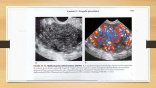 ECOGRAFIA GINECOLOGICA.pptx