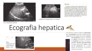 Ecografia hepatica
 