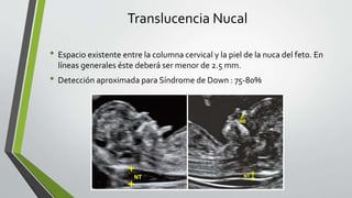 Translucencia Nucal
• Espacio existente entre la columna cervical y la piel de la nuca del feto. En
líneas generales éste deberá ser menor de 2.5 mm.
• Detección aproximada para Síndrome de Down : 75-80%
 