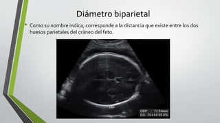 Diámetro biparietal
• Como su nombre indica, corresponde a la distancia que existe entre los dos
huesos parietales del cráneo del feto.
 