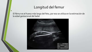 Longitud del femur
•
El fémur es el hueso más largo del feto, por eso se utiliza en la estimación de
la edad gestacional del bebé
 
