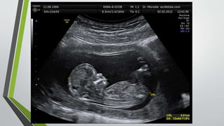 Ecografia obstetrica