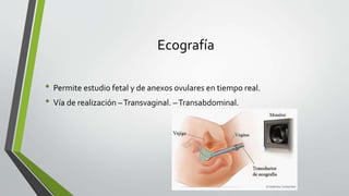 Ecografía
• Permite estudio fetal y de anexos ovulares en tiempo real.
• Vía de realización –Transvaginal. –Transabdominal.
 