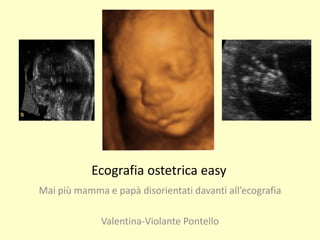 Ecografia ostetrica easy
Mai più mamma e papà disorientati davanti all’ecografia
Valentina-Violante Pontello
 