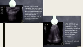 Ecografia pulmonar.pptx