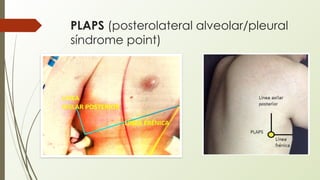 ECOGRAFIA PULMONAR evaluacion en sala internacion.pptx