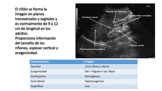 Ecografía Renal, medicina en image.pptx