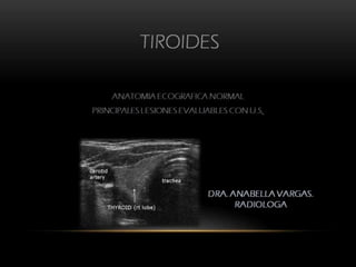 DIAGNOSTICO POR IMAGENES DE LA TIROIDES DRA. VARGAS PINEDA