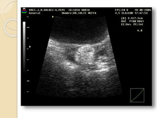 Ecografia tocoginecologica