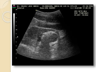 Ecografia tocoginecologica