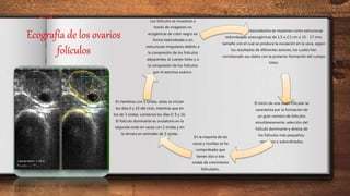 Ecografía de los ovarios
folículos
Los folículos preovulatorios se muestran como estructuras
redondeadas anecogénicas de 1,5 a 2,5 cm o 15 - 17 mm,
tamaño con el cual se produce la ovulación en la vaca, según
los resultados de diferentes autores, los cuales han
corroborado sus datos con la posterior formación del cuerpo
lúteo.
El inicio de una onda folicular se
caracteriza por la formación de
un gran número de folículos
simultáneamente, selección del
folìculo dominante y atresia de
los folículos más pequeños,
recesivos o subordinados.
En la mayoría de las
vacas y novillas se ha
comprobado que
tienen dos o tres
ondas de crecimiento
folículares..
En hembras con 2 ondas, estas se inician
los días 0 y 10 del ciclo, mientras que en
los de 3 ondas, comienza los días 0, 9 y 16.
El folículo dominante es ovulatorio en la
segunda onda en vacas con 2 ondas y en
la tercera en animales de 3 ondas
Los folículos se muestran a
través de imágenes no
ecogénicas de color negro en
forma redondeada o en
estructuras irregulares debido a
la compresión de los folículos
adyacentes, al cuerpo lúteo y a
la compresión de los folículos
por el estróma ovárico.
 