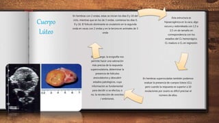Cuerpo
Lúteo
Esta estructura es
hipoecogénica en la vaca, algo
oscura y redondeada con 1,5 a
3,5 cm de tamaño en
correspondencia con los
estadíos del CL hemorrágico,
CL maduro o CL en regresión.
En hembras superovuladas también podemos
evaluar la presencia de cuerpos lúteos (CL),
pero cuando la respuesta es superior a 10
ovulaciones por ovario es difícil precisar el
número de ellos.
Sin embargo, la ecografía nos
permite hacer una valoración
más precisa de la respuesta
superovulatoria, determinar la
presencia de folículos
anovulatorios y descubrir
estados patológicos, cuya
información es fundamental
para decidir si se efectúa, o
no, la recolección de ovocitos
/ embriones.
En hembras con 2 ondas, estas se inician los días 0 y 10 del
ciclo, mientras que en los de 3 ondas, comienza los días 0,
9 y 16. El folículo dominante es ovulatorio en la segunda
onda en vacas con 2 ondas y en la tercera en animales de 3
onda
 