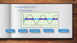 Principios Básicos de la
Ultrasonografía
Periodo Amplitud Velocidad Frecuencia Longitud
 