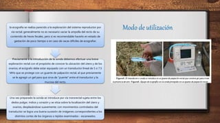 Modo de utilización
la ecografía se realiza parecido a la exploración del sistema reproductor por
vía rectal; generalmente no es necesario vaciar la ampolla del recto de su
contenido de heces fecales, pero sí es recomendable hacerlo en estado de
gestación de poco tiempo o en caso de vacas difíciles de ecografiar.
Previamente a la introducción de la sonda debemos efectuar una breve
exploración rectal con el propósito de conocer la ubicación del útero y de los
ovarios; el ecógrafo debe estar equipado con un transductor lineal de 5 o 7.5
MHz que se protege con un guante de palpación rectal, al que previamente
se le agregó un gel para que sirva de “puente” entre el transductor y la
mucosa del recto.
Una vez preparado la sonda se introduce por vía transrectal sujeta entre los
dedos pulgar, índice y corazón y se sitúa sobre la localización del ùtero y
ovarios, desplazándose suavemente; con movimientos controlados del
transductor se logra una buena sucesión de imágenes correspondientes a los
distintos cortes de los órganos o tejidos examinados - escaneados.
 