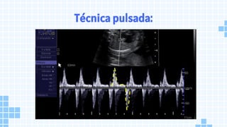 Técnica pulsada:
 