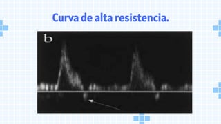 Curva de alta resistencia.
 