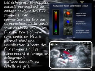 Les échographes Doppler
actuels permettent un
codage couleur des flux
sanguins. Par
convention, les flux qui
s'approchent de la sonde
sont codés en rouge, les
flux qui s'en éloignent
sont codés en bleu. Il
permet ainsi une
visualisation directe des
flux sanguins qui se
superposent à l'image en
échographie
bidimensionnelle en
échelle de gris.
 
