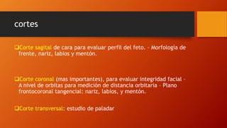 cortes
Corte sagital de cara para evaluar perfil del feto. – Morfología de
frente, nariz, labios y mentón.
Corte coronal (mas importantes), para evaluar integridad facial –
A nivel de orbitas para medición de distancia orbitaria – Plano
frontocoronal tangencial: nariz, labios, y mentón.
Corte transversal: estudio de paladar
 