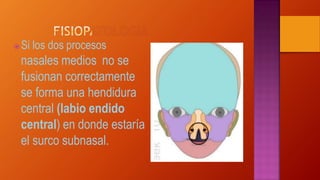  Si los dos procesos
nasales medios no se
fusionan correctamente
se forma una hendidura
central (labio endido
central) en donde estaría
el surco subnasal.
 