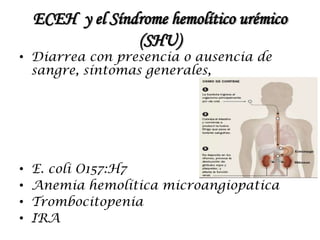 ECEH y el Síndrome hemolítico urémico
(SHU)
• Diarrea con presencia o ausencia de
sangre, síntomas generales,
• E. coli O157:H7
• Anemia hemolítica microangiopatica
• Trombocitopenia
• IRA
 