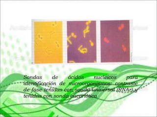 Sondas de ácidos nucleicos para
identificación de microorganismos: contraste
de fase teñidas con sonda universal (RNAr) y
teñidas con sonda eucariótica
 
