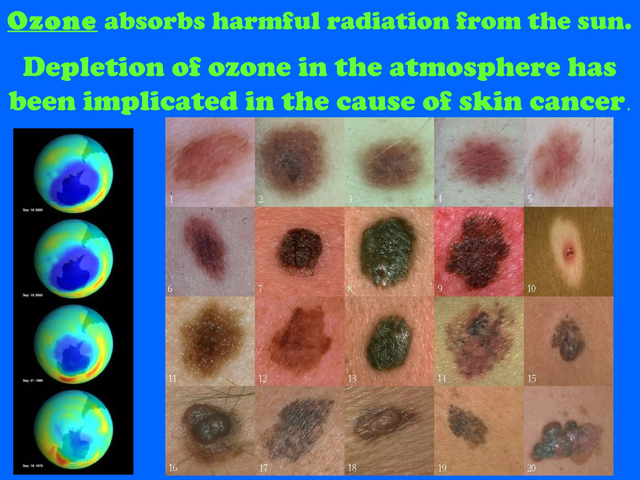 Ozone absorbs harmful radiation from the sun.
Depletion of ozone in the atmosphere has
been implicated in the cause of skin cancer.
 