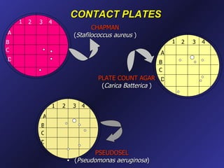 CONTACT PLATES
    1   2   3       4
                                   CHAPMAN
A                           (Stafilococcus aureus )
B                                                          1   2   3   4
C
                                                       A
D
                                                       B
                                                       C
                                    PLATE COUNT AGAR D
                                     (Carica Batterica )


                    1   2   3   4
                A
            B
            C
            D
                                   PSEUDOSEL
                            (Pseudomonas aeruginosa)
 