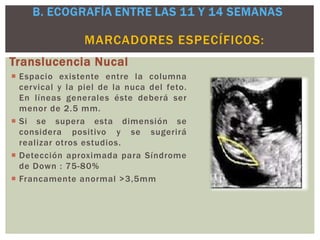 Translucencia Nucal
 Espacio existente entre la columna
cervical y la piel de la nuca del feto.
En líneas generales éste deberá ser
menor de 2.5 mm.
 Si se supera esta dimensión se
considera positivo y se sugerirá
realizar otros estudios.
 Detección aproximada para Síndrome
de Down : 75-80%
 Francamente anormal >3,5mm
MARCADORES ESPECÍFICOS:
 